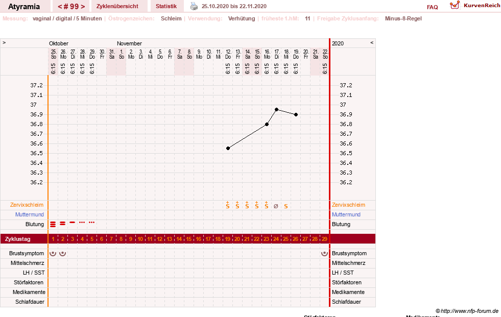 NFP-Kurve User #18796