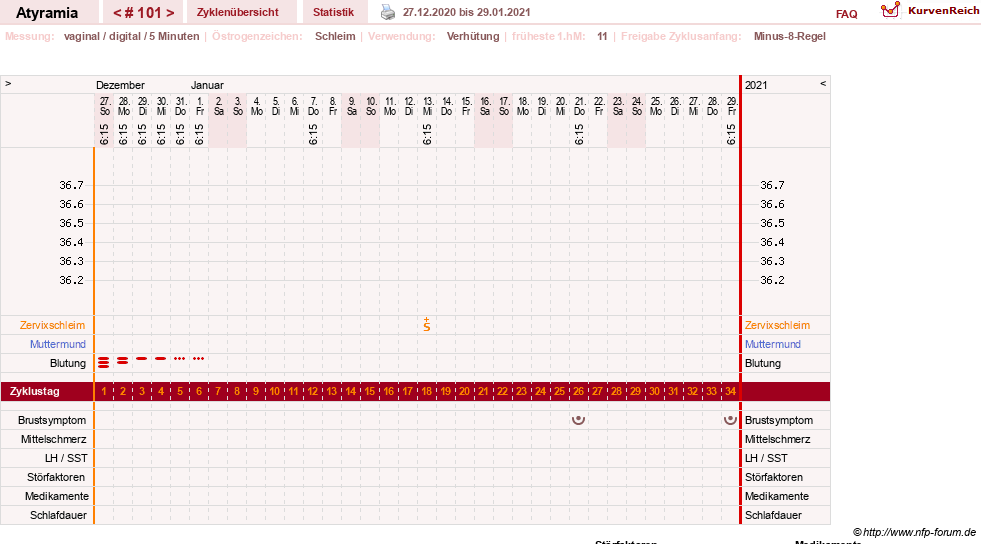 NFP-Kurve User #18796