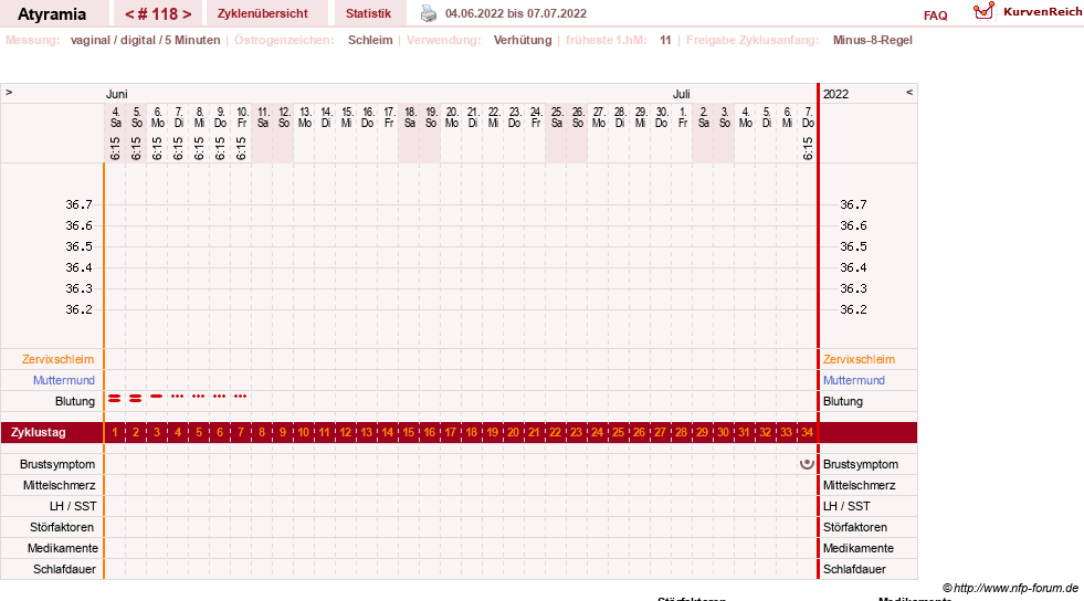 NFP-Kurve User #18796
