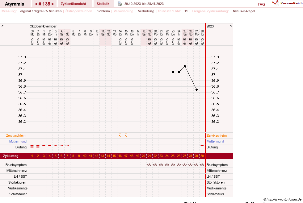 NFP-Kurve User #18796