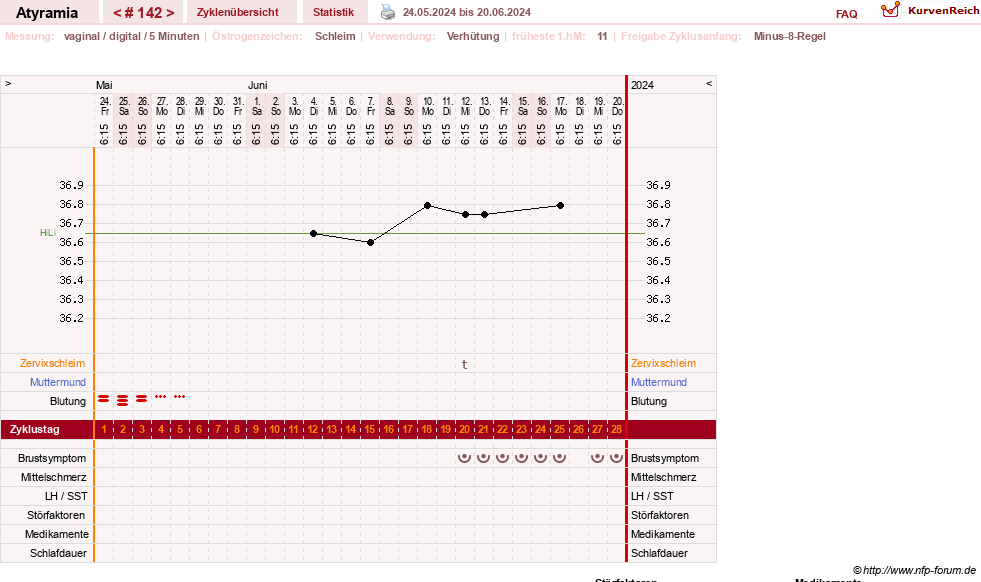 NFP-Kurve User #18796