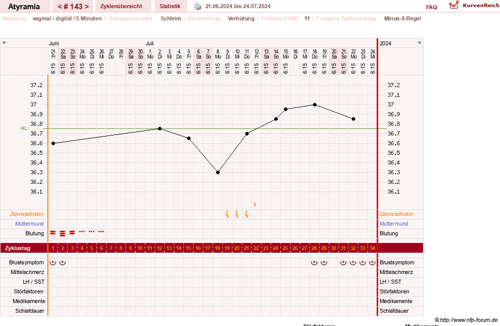 NFP-Kurve User #18796