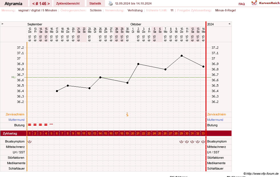 NFP-Kurve User #18796