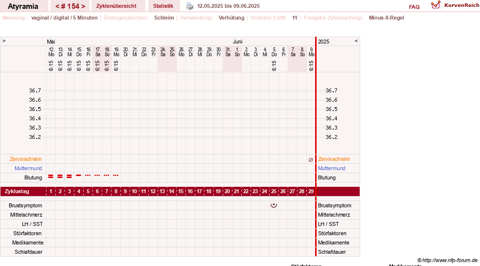 NFP-Kurve User #18796