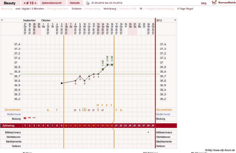 NFP-Kurve User #18817