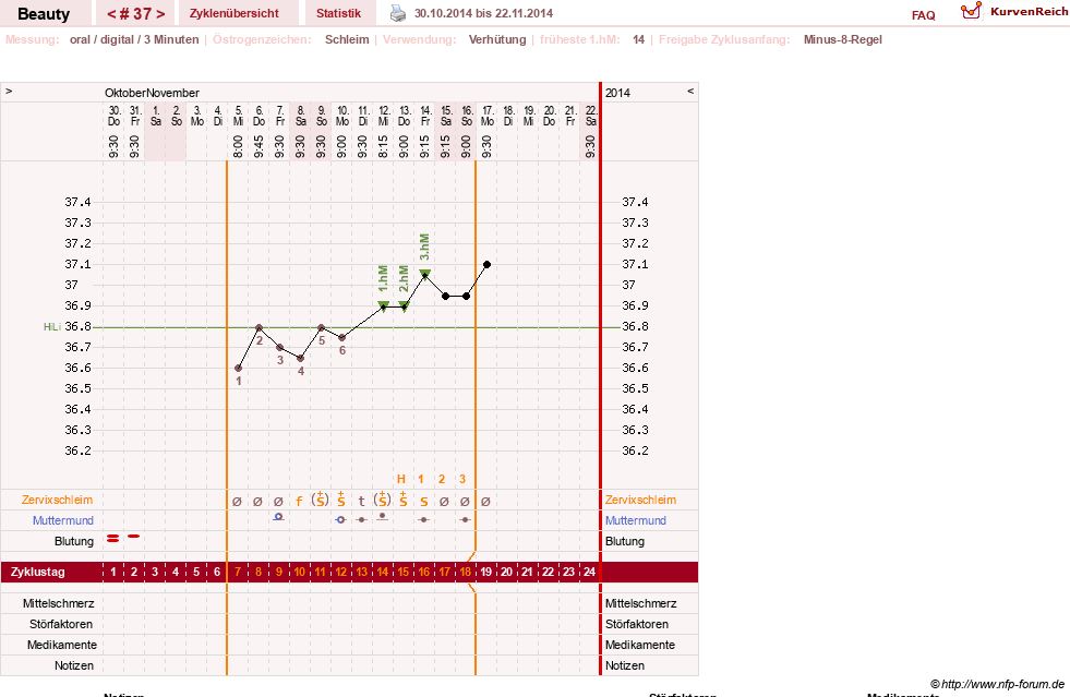 NFP-Kurve User #18817