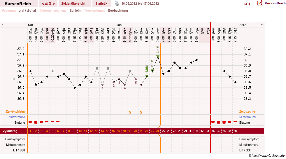 NFP-Kurve User #18842