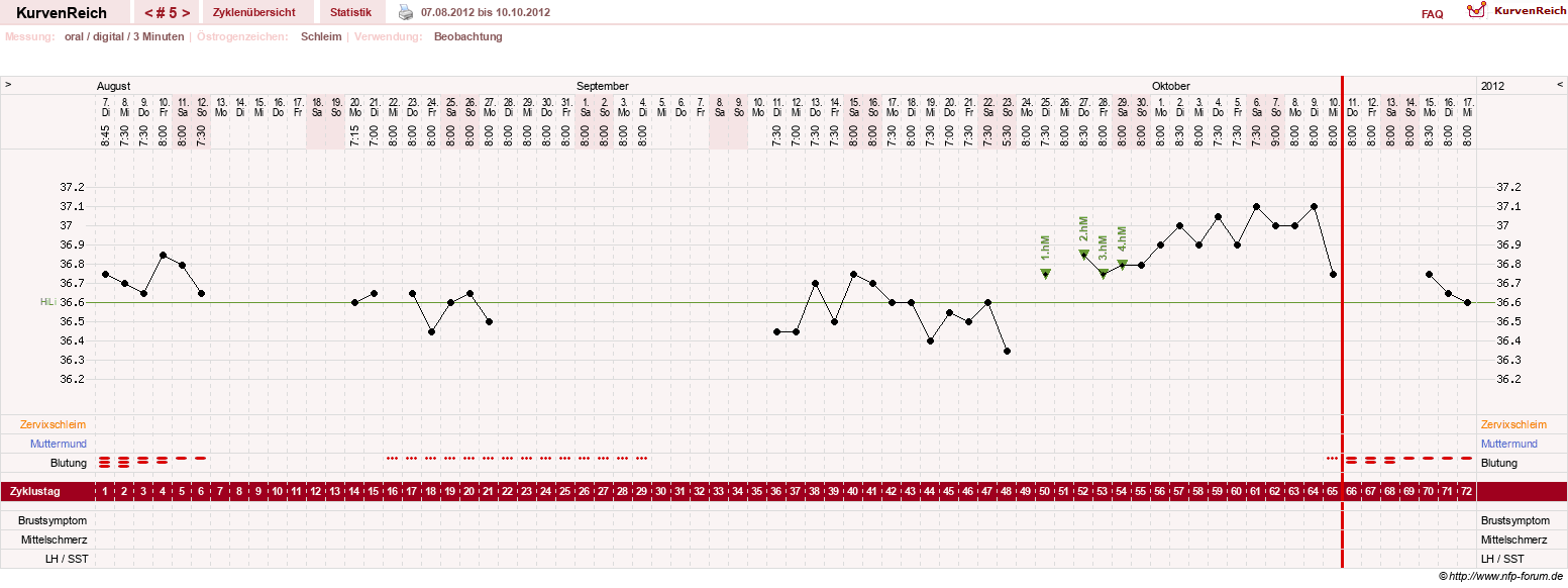 NFP-Kurve User #18842
