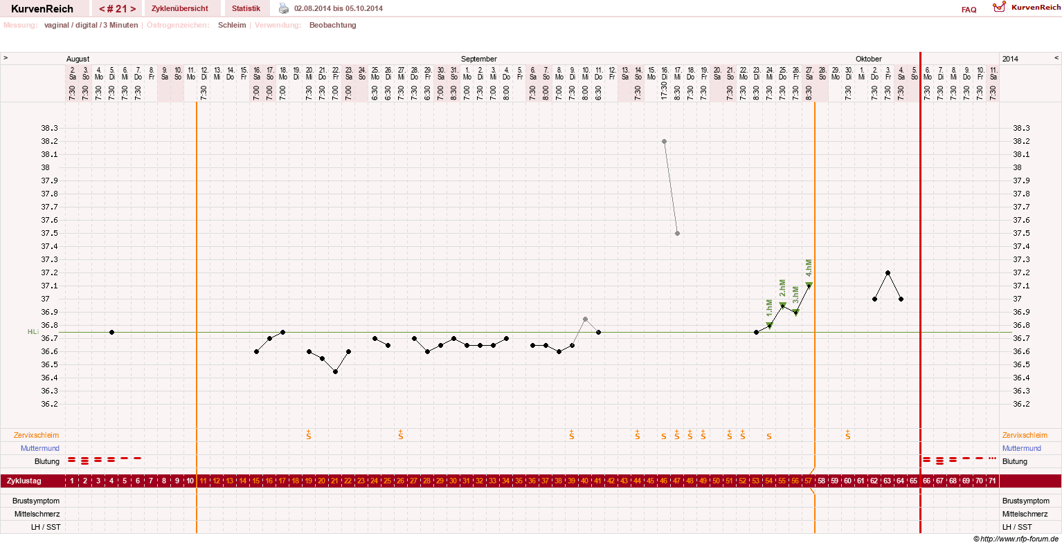 NFP-Kurve User #18842