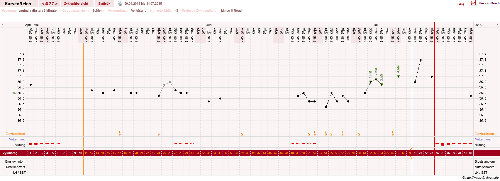 NFP-Kurve User #18842