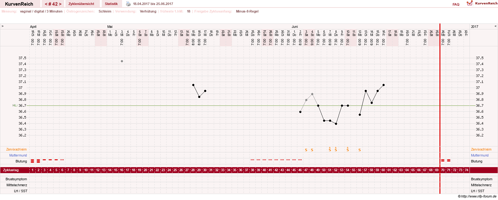 NFP-Kurve User #18842