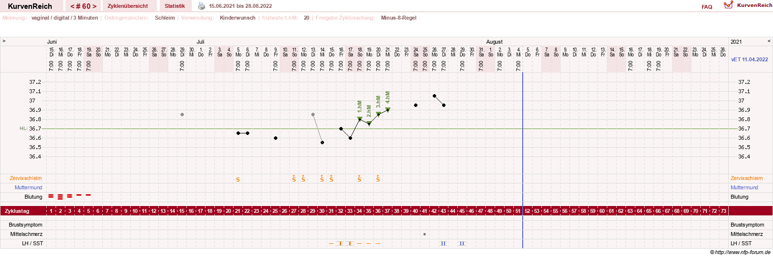 NFP-Kurve User #18842