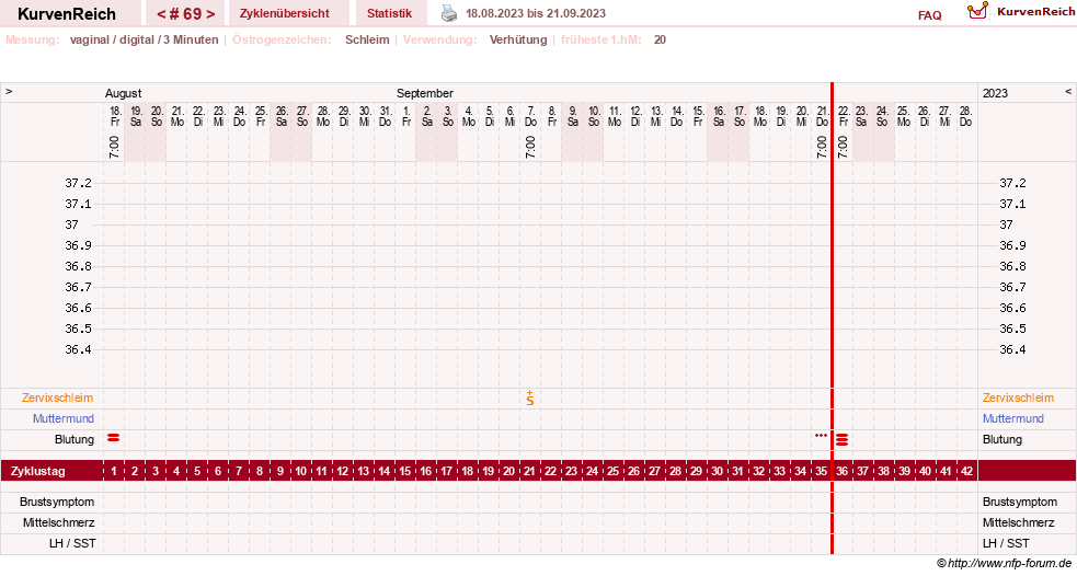 NFP-Kurve User #18842