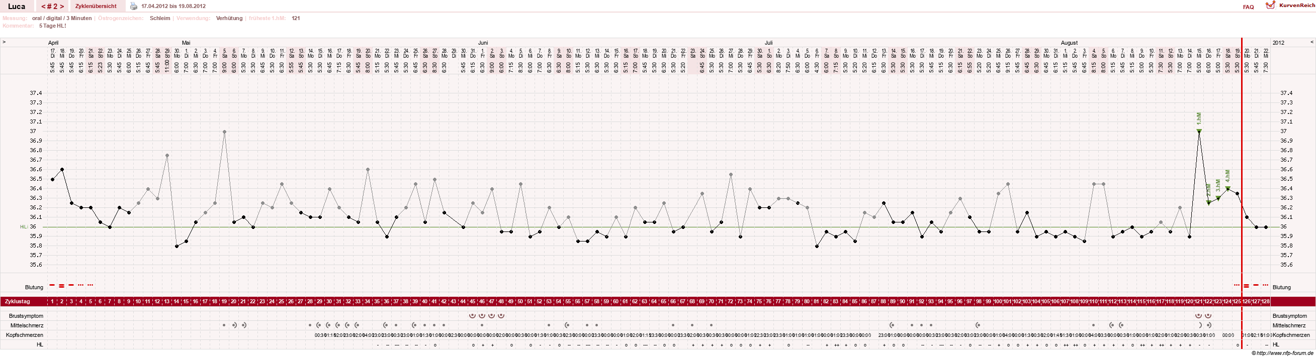 NFP-Kurve User #19059