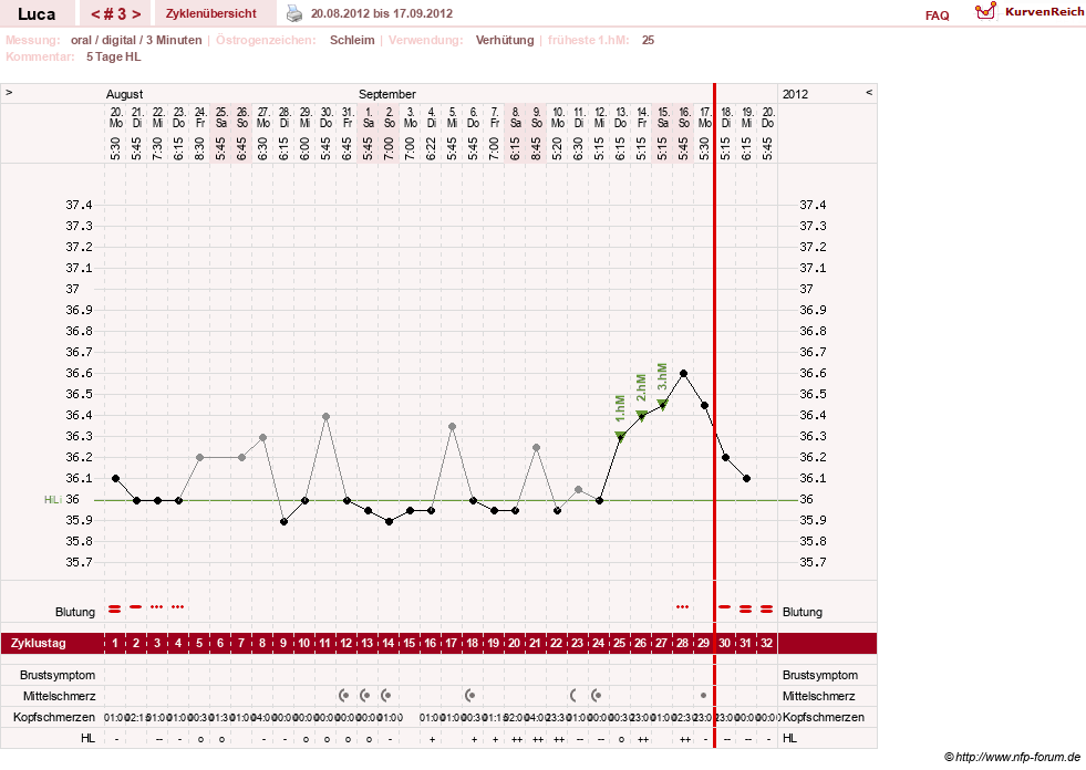 NFP-Kurve User #19059