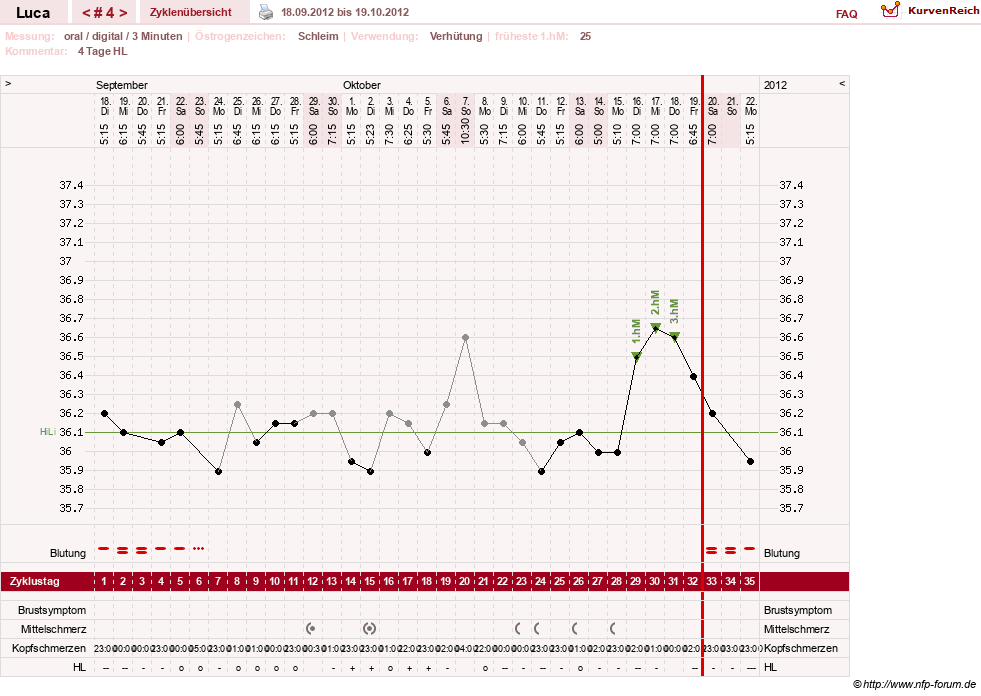 NFP-Kurve User #19059