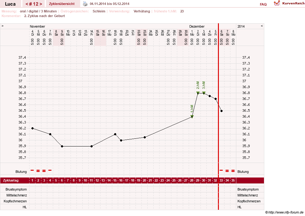 NFP-Kurve User #19059