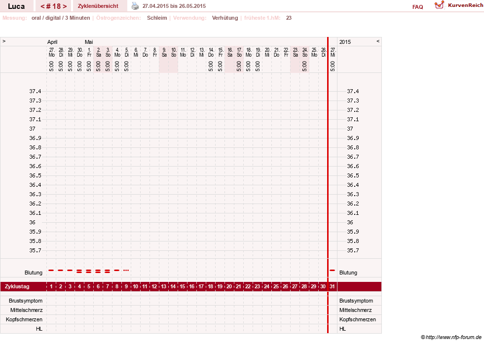 NFP-Kurve User #19059