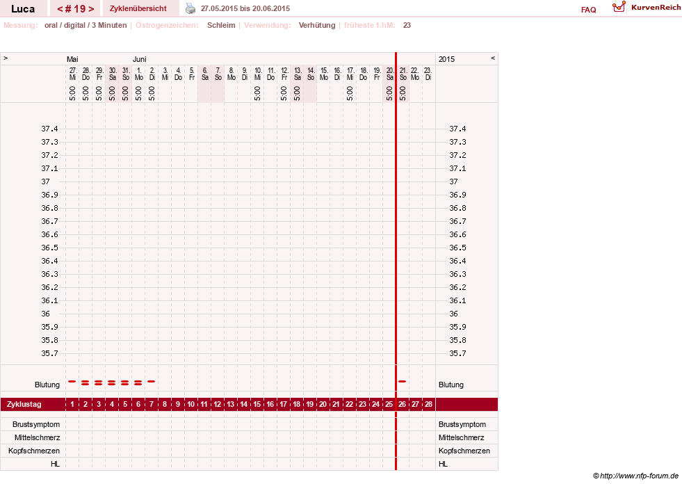 NFP-Kurve User #19059