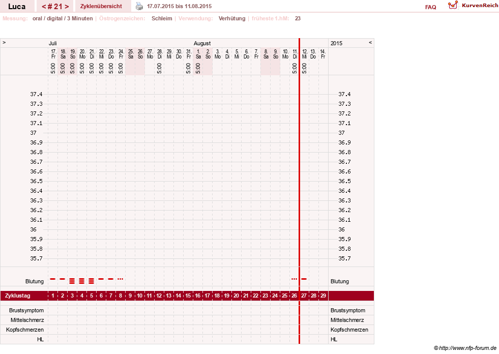 NFP-Kurve User #19059