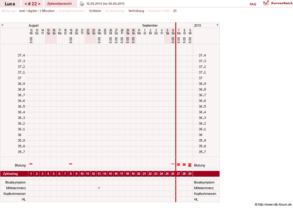 NFP-Kurve User #19059