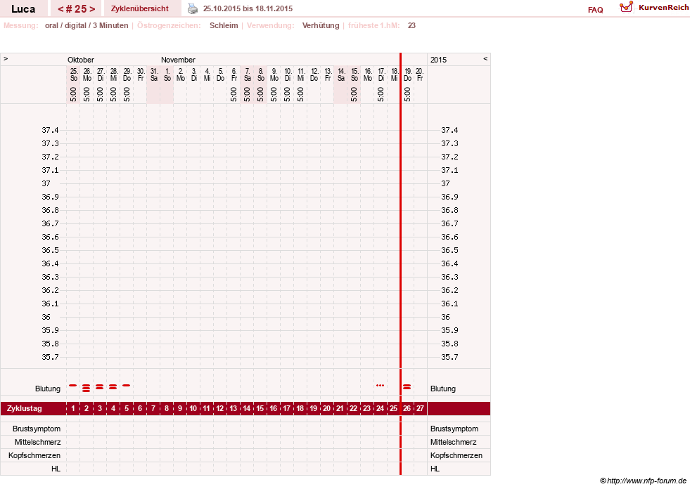 NFP-Kurve User #19059