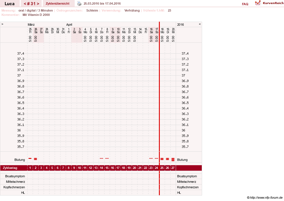 NFP-Kurve User #19059