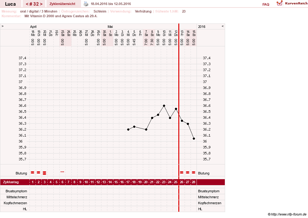 NFP-Kurve User #19059