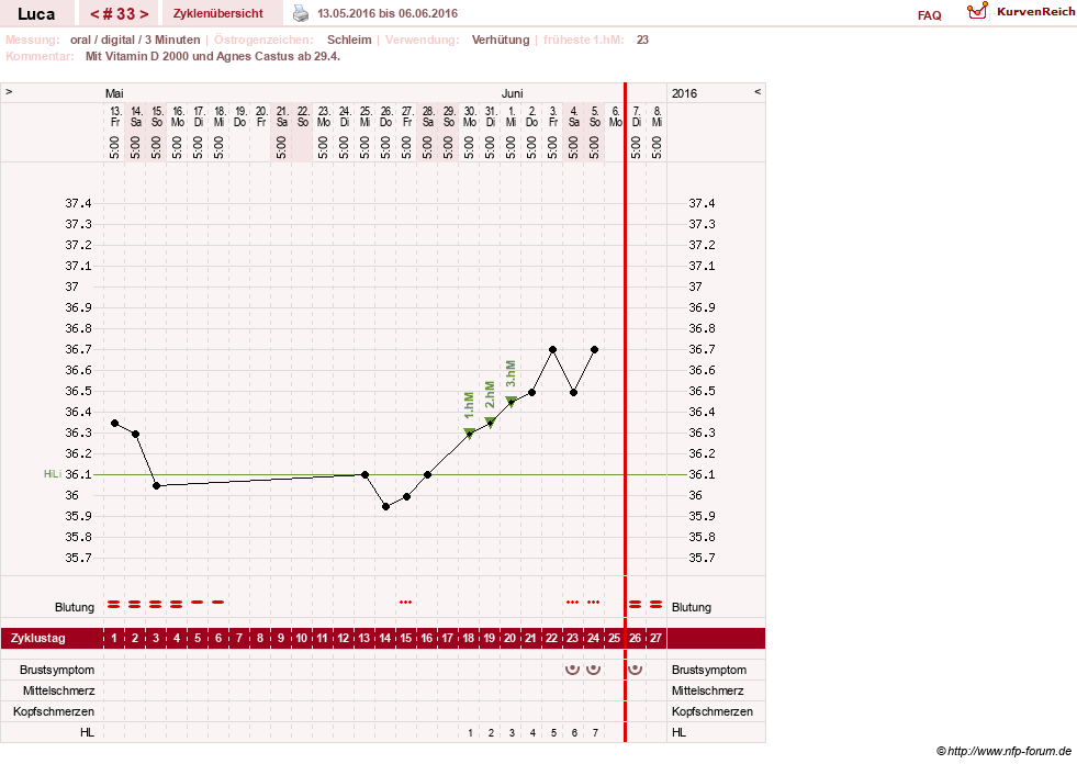 NFP-Kurve User #19059