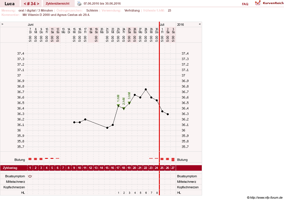NFP-Kurve User #19059