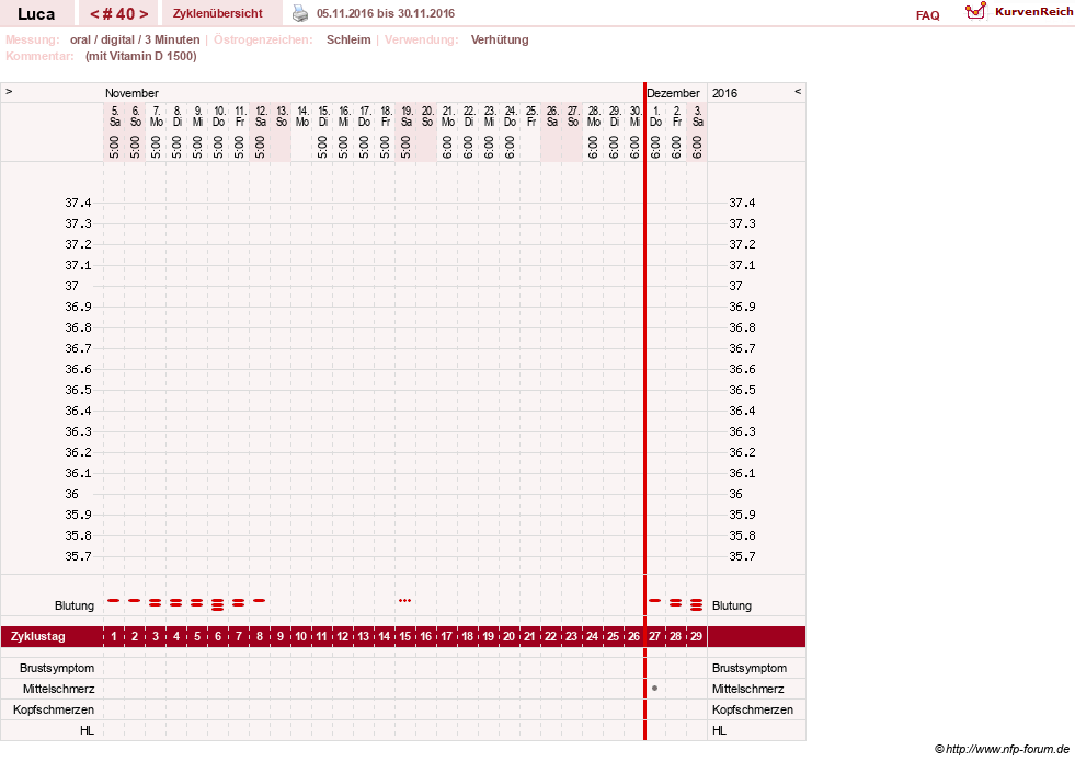 NFP-Kurve User #19059