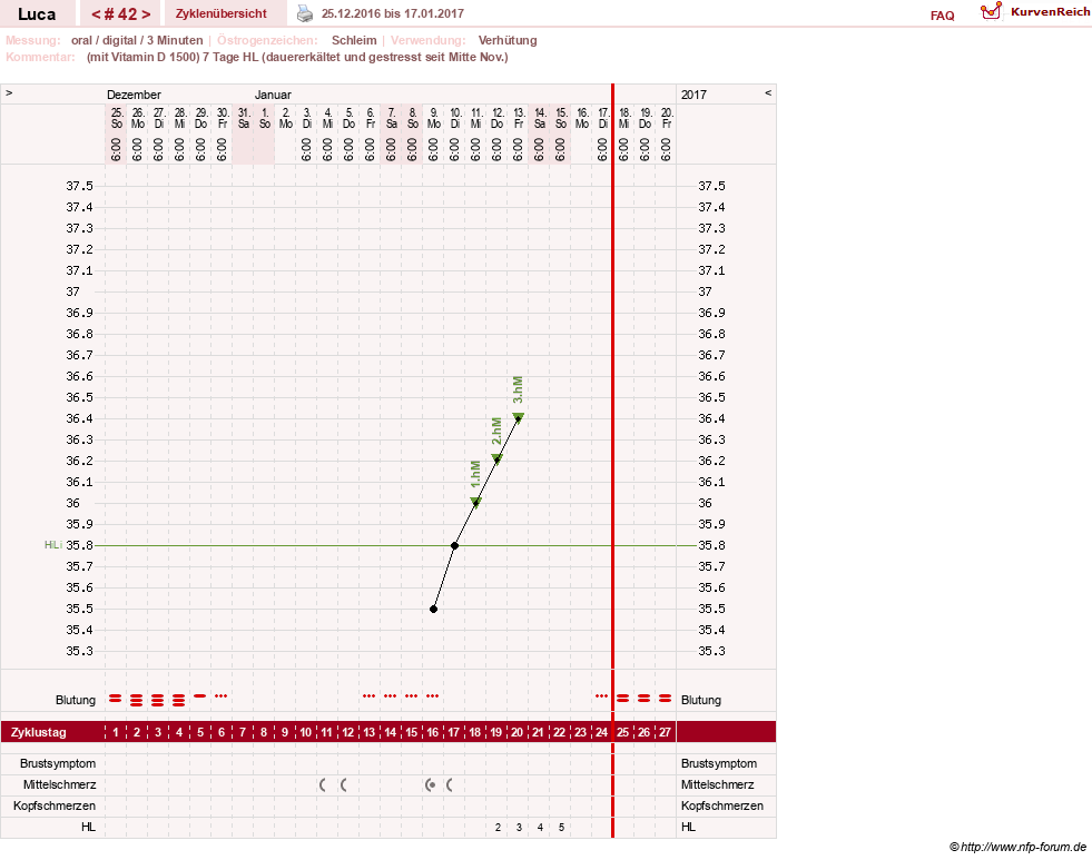 NFP-Kurve User #19059