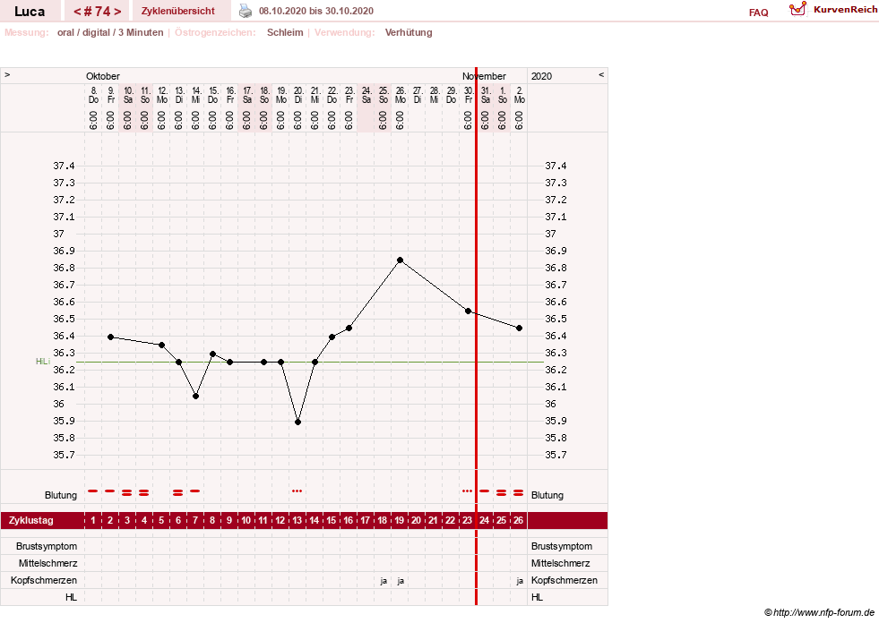 NFP-Kurve User #19059