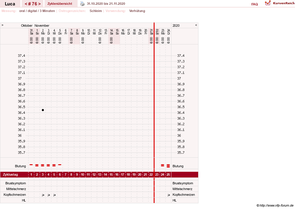 NFP-Kurve User #19059