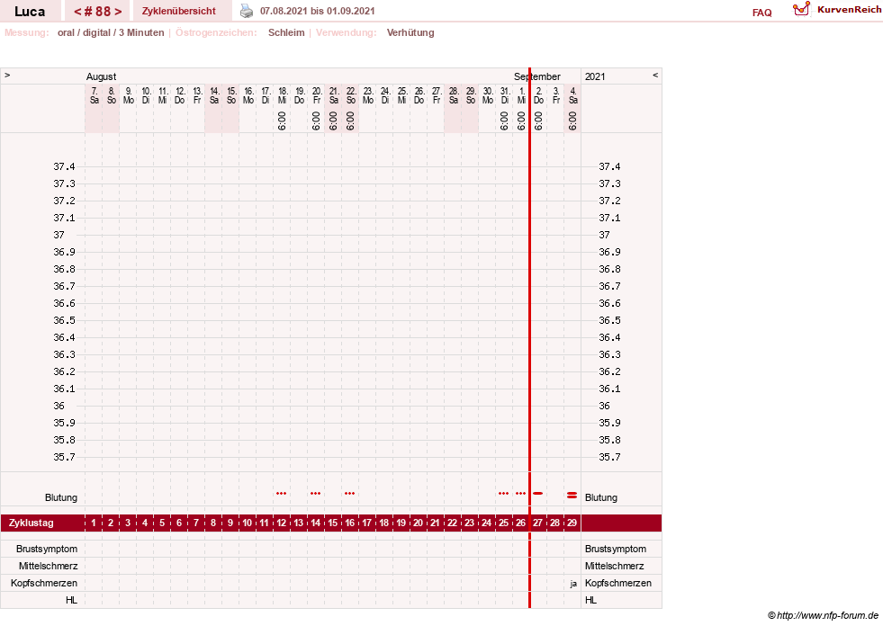 NFP-Kurve User #19059