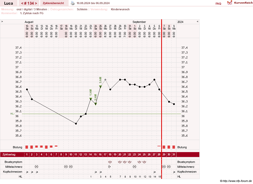 NFP-Kurve User #19059