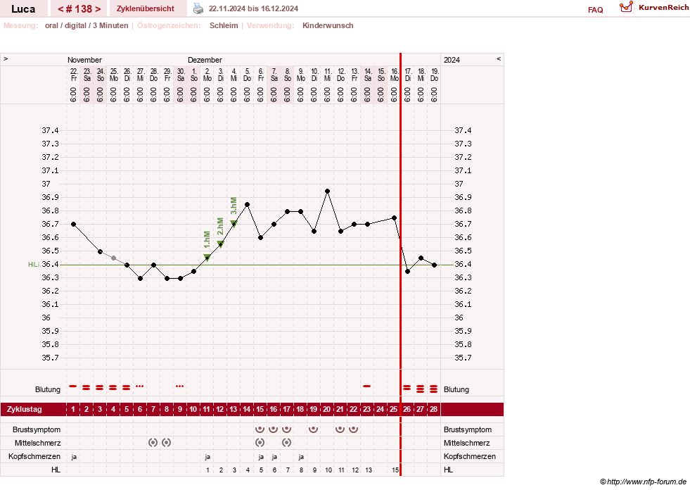 NFP-Kurve User #19059