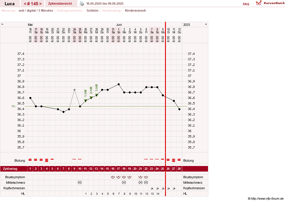 NFP-Kurve User #19059