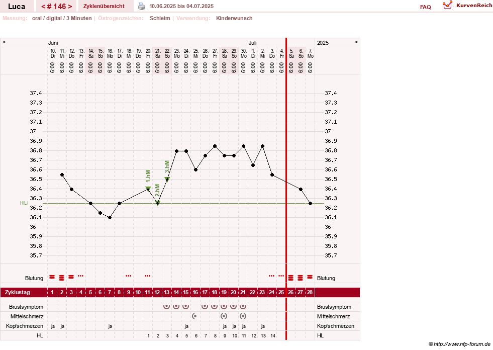 NFP-Kurve User #19059