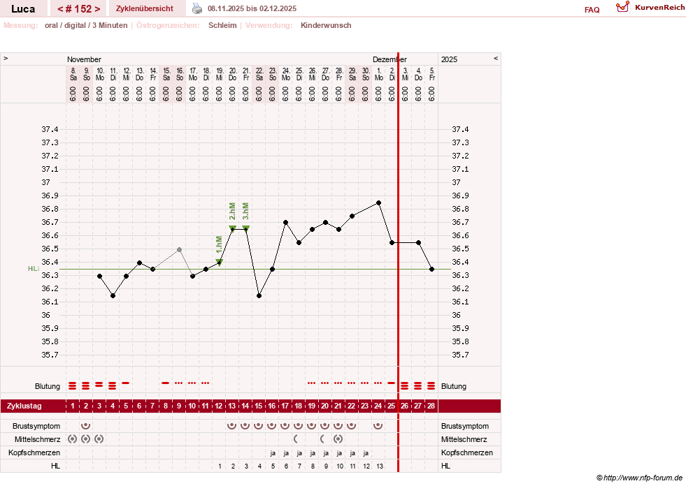 NFP-Kurve User #19059