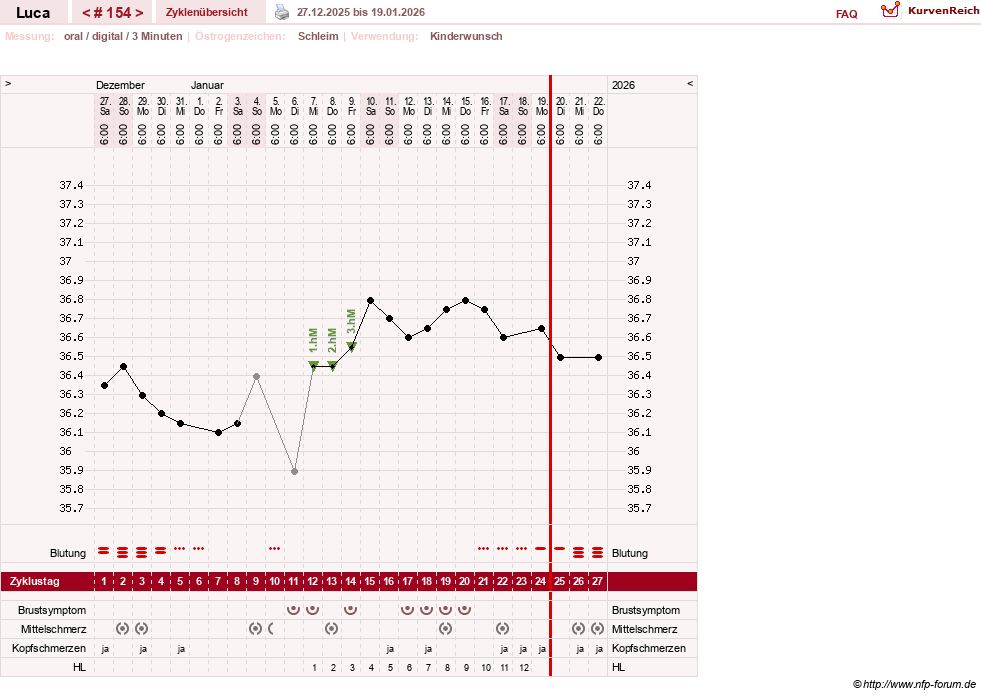 NFP-Kurve User #19059