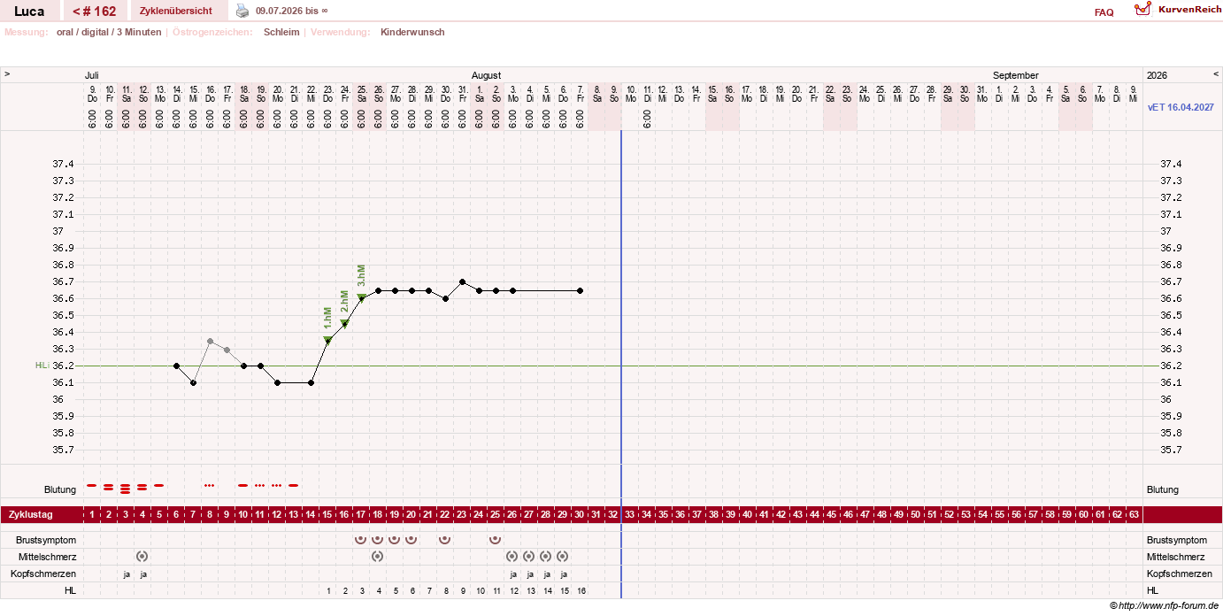 NFP-Kurve User #19059