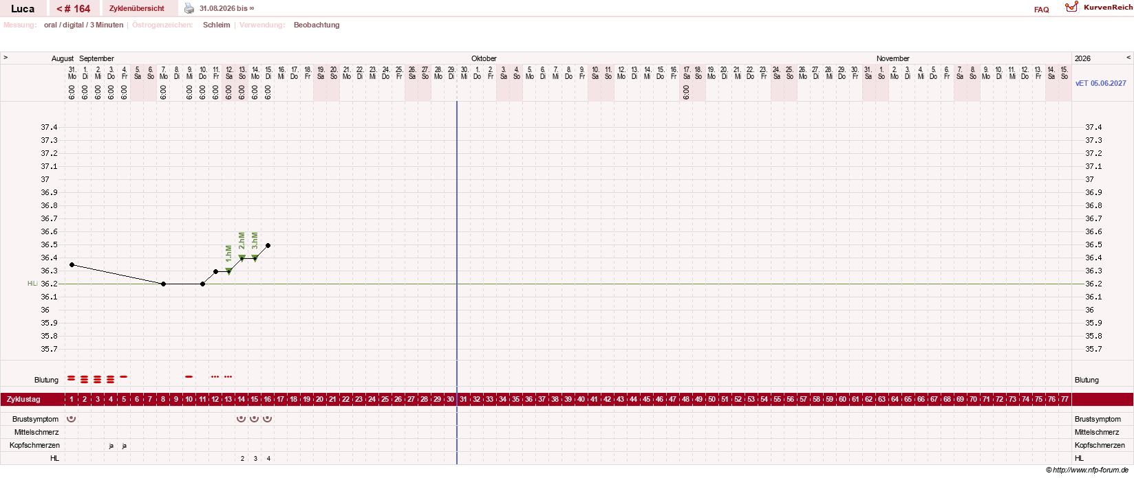 NFP-Kurve User #19059