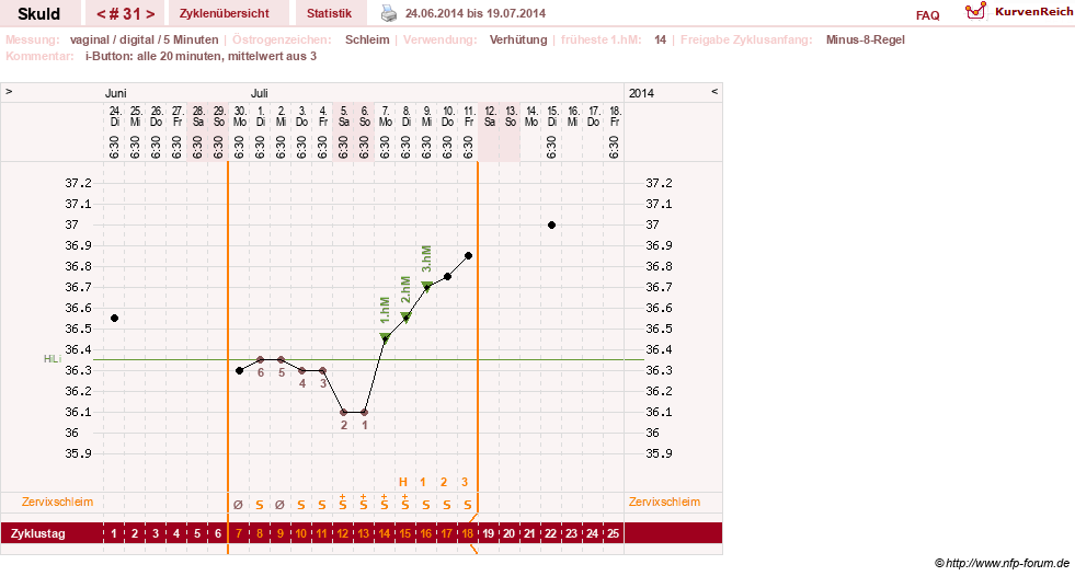 NFP-Kurve User #19086