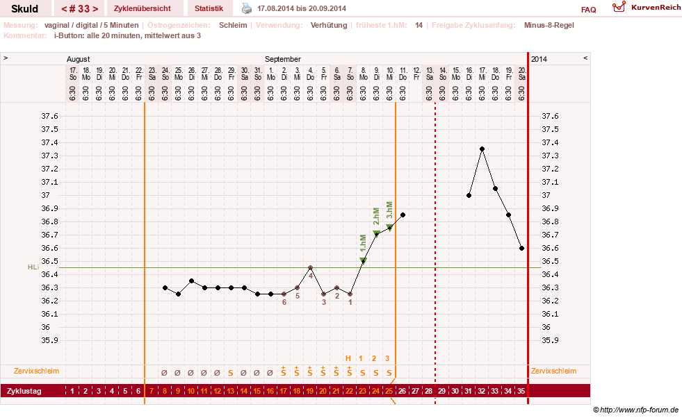 NFP-Kurve User #19086