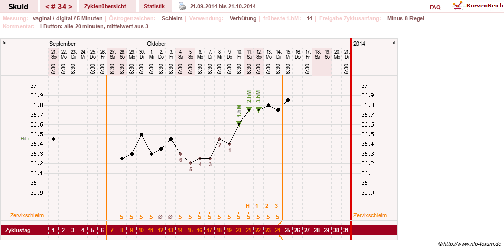 NFP-Kurve User #19086