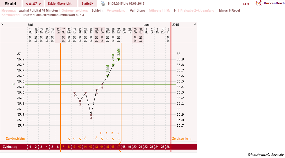 NFP-Kurve User #19086