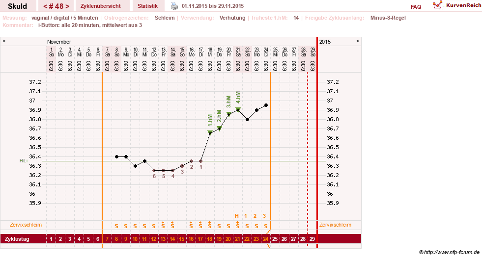 NFP-Kurve User #19086