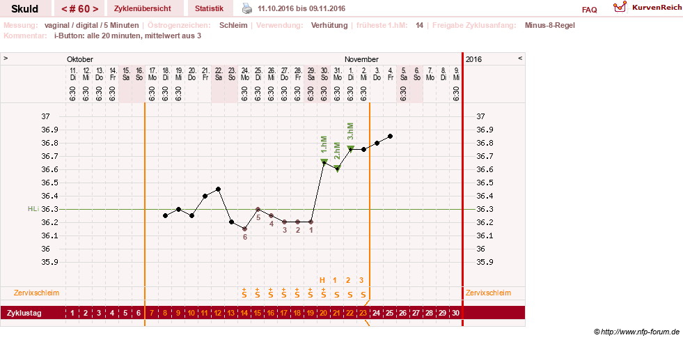 NFP-Kurve User #19086