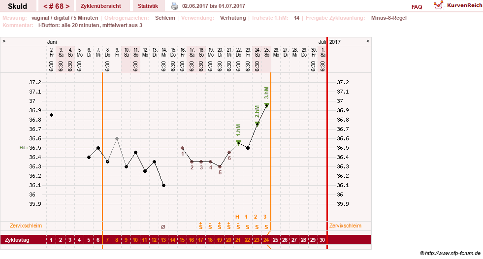 NFP-Kurve User #19086